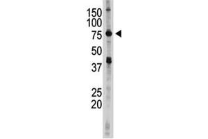 IKKE antibody used in western blot to detect IKKE in 293 cell lysate (IKKi/IKKe 抗体  (AA 686-716))