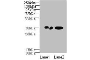 Western blot All lanes: RPRD1A antibody at 2 μg/mL Lane 1: A431 whole cell lysate Lane 2: Jurkat whole cell lysate Secondary Goat polyclonal to Rabbit IgG at 1/10000 dilution Predicted band size: 36, 32 kDa Observed band size: 36 kDa (RPRD1A 抗体  (AA 2-276))