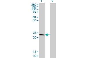 Western Blot analysis of TPD52 expression in transfected 293T cell line by TPD52 monoclonal antibody (M01), clone 1B6. (TPD52 抗体  (AA 100-184))