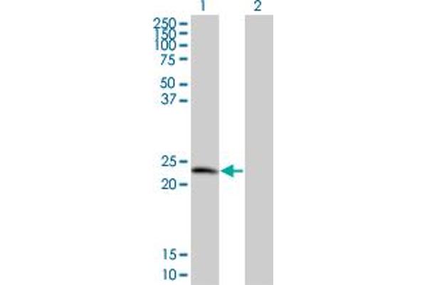 TPD52 抗体  (AA 100-184)