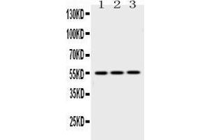 Western blot analysis of Caspase8 using anti-Caspase8 antibody . (Caspase 8 抗体  (N-Term))