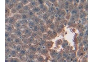 Immunohistochemistry (IHC) image for anti-Glutathione S-Transferase kappa 1 (GSTK1) (AA 19-222) antibody (ABIN7440020)