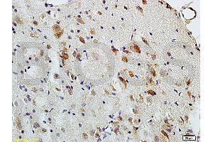 Formalin-fixed and paraffin embedded: rat brain tissue labeled with Anti-MBP Polyclonal Antibody (ABIN739400), Unconjugated at 1:200, followed by conjugation to the secondary antibody and DAB staining