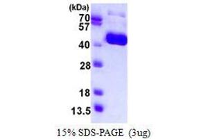 Influenza Hemagglutinin HA1 Chain (HA1) protein (His tag)