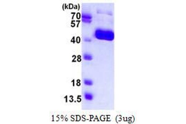 Influenza Hemagglutinin HA1 Chain (HA1) protein (His tag)