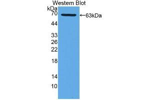 Western blot analysis of the recombinant protein. (XDH 抗体  (AA 1-300))
