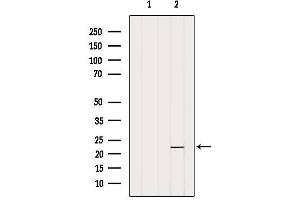 Western blot analysis of extracts from Hela, using OBFC2A Antibody. (OBFC2A 抗体  (Internal Region))