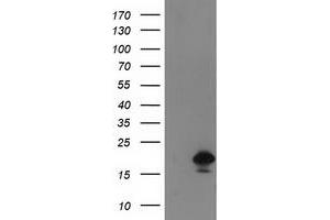 HEK293T cells were transfected with the pCMV6-ENTRY control (Left lane) or pCMV6-ENTRY DSTN (Right lane) cDNA for 48 hrs and lysed. (Destrin 抗体)