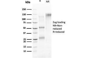 SDS-PAGE Analysis Purified HER-4 / ERBB4 Mouse Monoclonal Antibody (ERBB4/2581). (ERBB4 抗体  (AA 1116-1269))