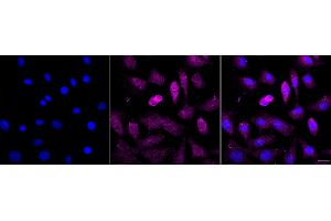 Immunocytochemical staining of C2C12 cells with Septin 2 antibody (ABIN7800295), 1:1,000). (Recombinant Septin 2 抗体)
