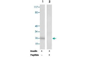 Western blot analysis of extracts from K-562 cells, treated with Insulin (0. (RPL10 抗体)