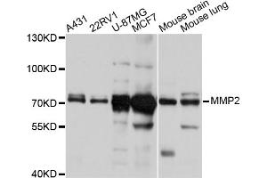 Western blot analysis of extracts of various cell lines, using MMP2 antibody (ABIN5998246) at 1/1000 dilution. (MMP2 抗体)