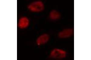 ABIN6274359 staining HuvEc cells by IF/ICC. (WTAP 抗体  (C-Term))