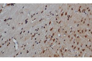 Immunohistochemistry of paraffin-embedded Mouse brain using GRP Polyclonal Antibody at dilution of 1:50 (Gastrin-Releasing Peptide 抗体)