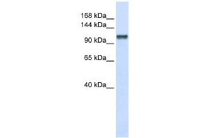 CHERP antibody used at 1 ug/ml to detect target protein. (CHERP 抗体  (Middle Region))