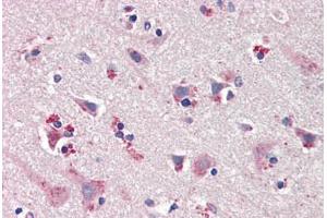 Human Brain, Cortex (formalin-fixed, paraffin-embedded) stained with NOS1 antibody ABIN461965 at 20 ug/ml followed by biotinylated goat anti-rabbit IgG secondary antibody ABIN481713, alkaline phosphatase-streptavidin and chromogen. (NOS1 抗体  (C-Term))
