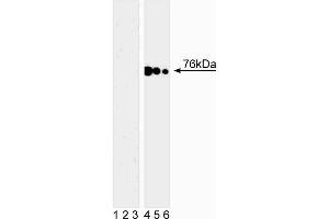 Western blot analysis of SLP-76 (pY128) in human T leukemia.