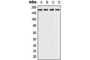 Western blot analysis of ROCK2 expression in MCf7 (A), HeLa (B), NIH3T3 (C), PC12 (D) whole cell lysates. (ROCK2 抗体  (C-Term))