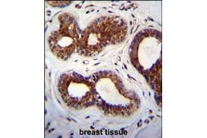 KIAA1586 Antibody immunohistochemistry analysis in formalin fixed and paraffin embedded human breast tissue followed by peroxidase conjugation of the secondary antibody and DAB staining. (KIAA1586 抗体  (N-Term))
