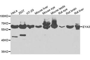 Western blot analysis of extracts of various cell lines, using EYA3 antibody (ABIN5975663) at 1/1000 dilution. (EYA3 抗体)