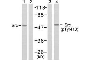 Western blot analysis of extracts from COLO205 cells using Src (Ab-418) antibody (E021115, Lane 1 and 2) and Src (phospho-Tyr418) antibody (E011091, Lane 3 and 4). (Src 抗体  (pTyr418))