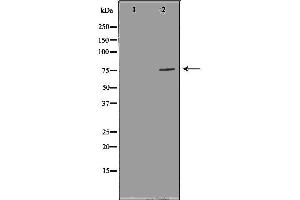 Western blot analysis of extracts of SKOV3, using FOXP1 antibody.