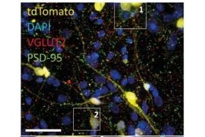 40x confocal images of mixed excitatory/inhibitory iN co-culture on astrocytes containing a small fraction of tdTomato-expressing iN cells. (tdTomato 抗体)