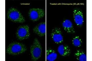 Immunofluorescence (IF) image for anti-Microtubule-Associated Protein 1 Light Chain 3 beta (MAP1LC3B) (AA 1-30) antibody (ABIN3031790)