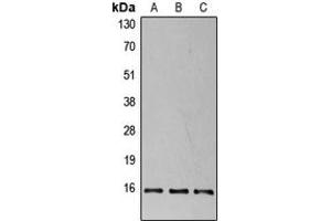 Western blot analysis of 4EBP1 (pT37) expression in HEK293T insulin-treated (A), NIH3T3 insulin-treated (B), PC12 insulin-treated (C) whole cell lysates.