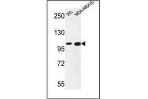 Western blot analysis of NCOA7 Antibody (N-term) in 293, MDA-MB435 cell line lysates (35ug/lane). (NCOA7 抗体  (N-Term))