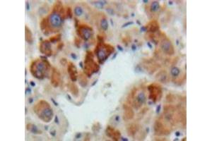 Used in DAB staining on fromalin fixed paraffin-embedded Liver tissue (Hepcidin 抗体  (AA 24-83))