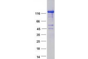 Western Blotting (WB) image for Ca++-Dependent Secretion Activator 2 (CADPS2) (Transcript Variant 1) protein (Myc-DYKDDDDK Tag) (ABIN2713033)