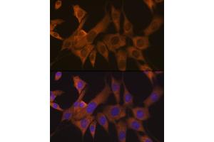Immunofluorescence analysis of NIH-3T3 cells using eIF3B Rabbit mAb (ABIN7267042) at dilution of 1:100 (40x lens). (EIF3B 抗体)