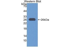 Western Blotting (WB) image for anti-B-Cell CLL/lymphoma 9 (BCL9) (AA 1118-1327) antibody (ABIN1866886) (BCL9 抗体  (AA 1118-1327))