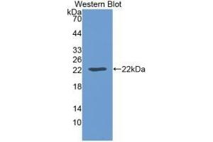 Detection of Recombinant LEP, Mouse using Monoclonal Antibody to Leptin (LEP) (Leptin 抗体  (AA 22-167))