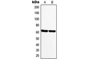 Western blot analysis of Monoamine Oxidase A expression in PC12 (A), Human heart (B) whole cell lysates. (Monoamine Oxidase A 抗体  (Center))