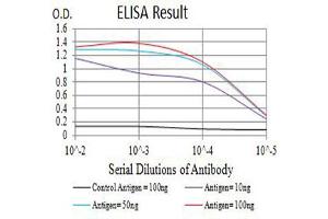 Black line: Control Antigen (100 ng),Purple line: Antigen (10 ng), Blue line: Antigen (50 ng), Red line:Antigen (100 ng) (IL2 Receptor beta 抗体  (AA 27-240))