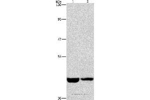 Western blot analysis of Hela and A431 cell, using CSNK1E Polyclonal Antibody at dilution of 1:1550 (CK1 epsilon 抗体)