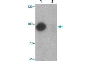 Western blot analysis of TSHZ1 in A-20 cell lysate with TSHZ1 polyclonal antibody  at 1 ug/mL in (lane 1) the absence and (lane 2) the presence of blocking peptide. (TSHZ1 抗体  (N-Term))