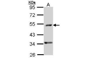 WB Image Sample (30 ug of whole cell lysate) A: A431 , 10% SDS PAGE antibody diluted at 1:1000 (PDSS2 抗体)