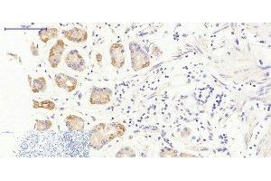 Immunohistochemistry of paraffin-embedded Human stomach tissue using JAK3 Polyclonal Antibody at dilution of 1:200. (JAK3 抗体)