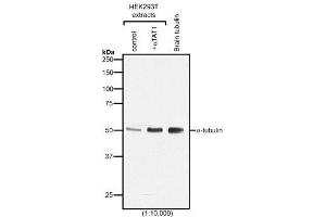 Western blot analysis of protein acetylation with anti-α-Tubulin (acetylated), mAb (TEU318) . (alpha Tubulin 抗体)