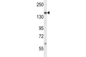 SRC-1 antibody western blot analysis in MDA-MB231 lysate. (NCOA1 抗体  (AA 594-625))