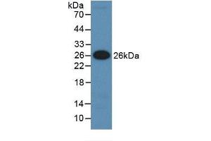 Detection of Recombinant IGFBP5, Human using Monoclonal Antibody to Insulin Like Growth Factor Binding Protein 5 (IGFBP5) (IGFBP5 抗体  (AA 27-248))
