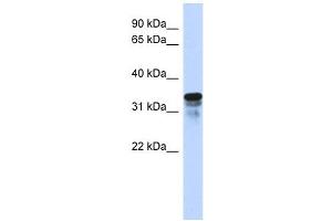 FAM82B antibody used at 1 ug/ml to detect target protein. (FAM82B 抗体  (N-Term))
