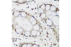 Immunohistochemistry of paraffin-embedded human gastric using CBX3 antibody (ABIN5971255) at dilution of 1/200 (40x lens). (CBX3 抗体)