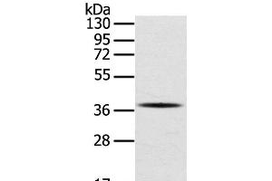 Western Blot analysis of A375 cell using SPARC Polyclonal Antibody at dilution of 1:400 (SPARC 抗体)