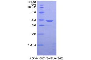 SDS-PAGE analysis of Mouse STAT1 Protein. (STAT1 蛋白)
