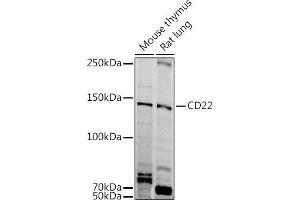 Western blot analysis of extracts of various cell lines, using CD22 antibody (ABIN6131253, ABIN6138143, ABIN6138144 and ABIN6221471) at 1:1000 dilution. (CD22 抗体  (AA 708-847))