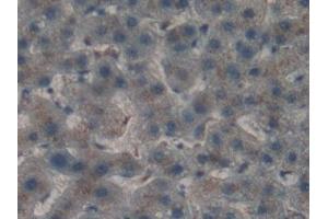 Immunohistochemistry (IHC) image for anti-Cathepsin A (CTSA) (AA 215-470) antibody (ABIN7438739)